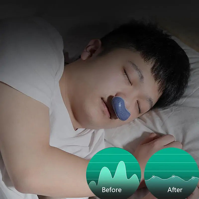 Anti-Snoring Clip Device